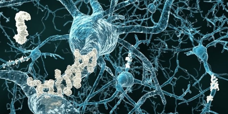 Seltene Genmutationen bei erblicher Alzheimer-Krankheit stören die Amyloidproduktion, wie eine Studie zeigt