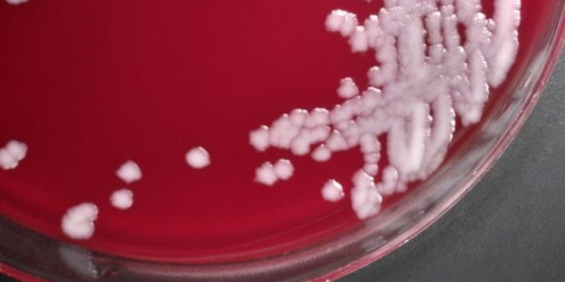 Ein gemeinsamer Entzündungsweg verwandelt Anthrax-Toxin in einen Killer