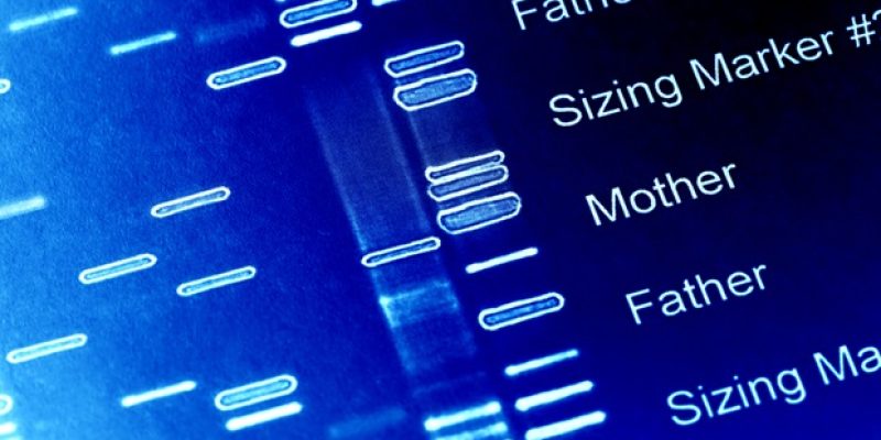 Eine schützende genetische Variante schützt schwarze Amerikaner vor dem Risiko einer Nierenerkrankung