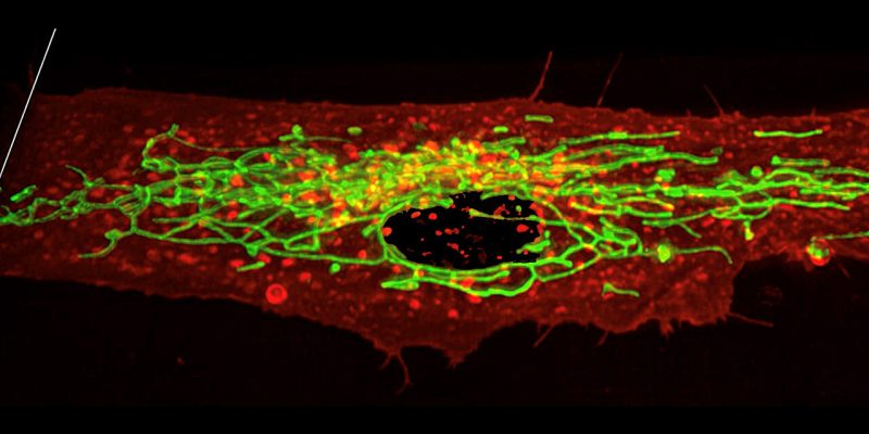 Blutuntersuchungen identifizieren Biomarker für Selbstmordgedanken