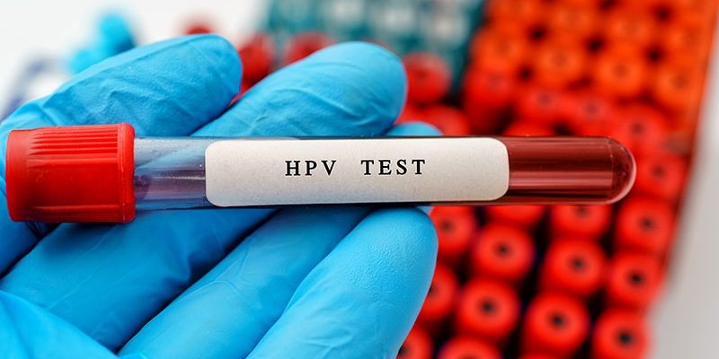 HPV-positiver Test: Wie man auf die Ängste der Patienten eingeht