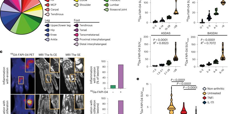 Laut einer neuen Studie spielen Fibroblastenzellen eine Schlüsselrolle bei der Lösung von Gelenkentzündungen