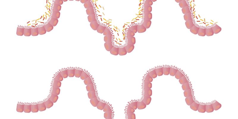 Lernen Sie Bifidobacterium breve kennen, das Babys gesund hält