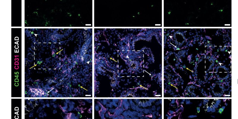 Untersuchungen zeigen, dass Immunzellen Lungengewebe vor der Geburt formen und neue Möglichkeiten zur Behandlung von Atemwegserkrankungen bieten