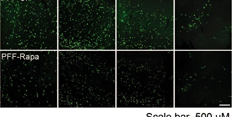 Neue Erkenntnisse über wichtige pathologische Proteine ​​bei der Parkinson-Krankheit eröffnen Wege für neuartige Therapien