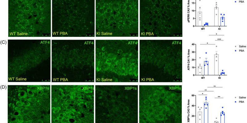 Neue Behandlung kehrt Symptome der Alzheimer-Krankheit um und verbessert Gedächtnisfunktion in präklinischer Studie