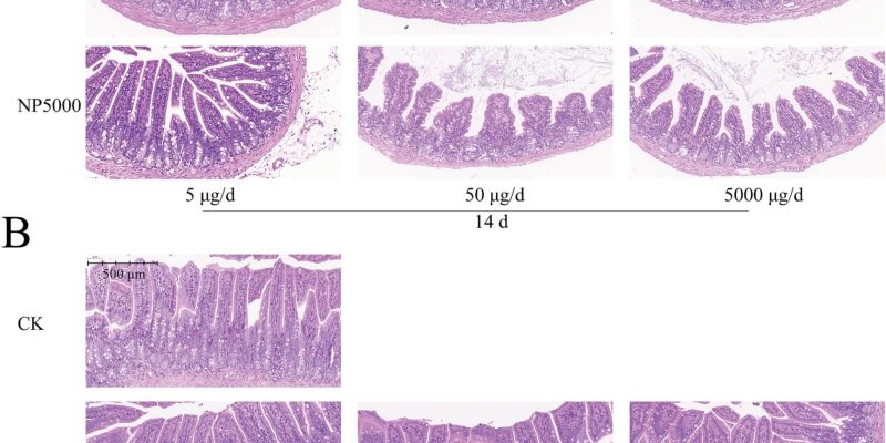 Studie zeigt, dass Plastikpartikel die Darmgesundheit und das Immunsystem von Mäusen schädigen