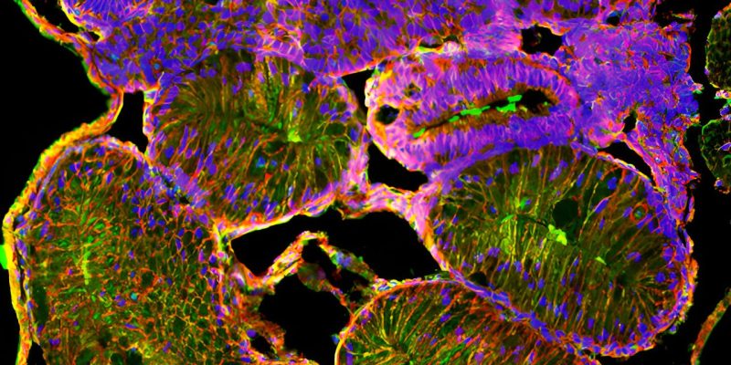 Studie an Froschembryonen hilft Wissenschaftlern, die menschliche Geburtsanomalie der Darmfehlrotation aufzuklären