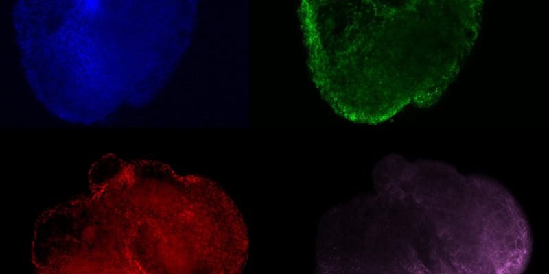 Forscher schaffen realistischere synthetische menschliche Miniherzen