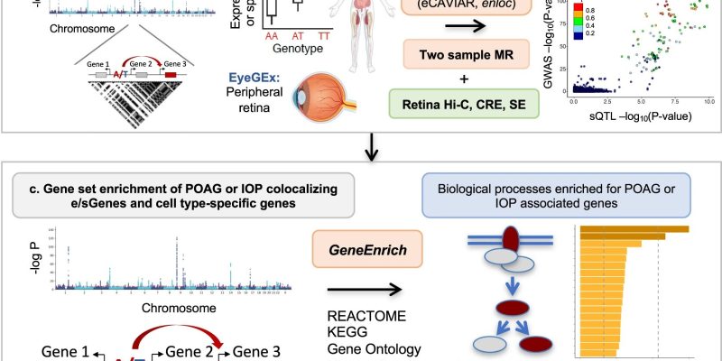 Forscher identifizieren Gene und Zelltypen, die möglicherweise eine ursächliche Rolle bei der Entstehung des primären Offenwinkelglaukoms spielen