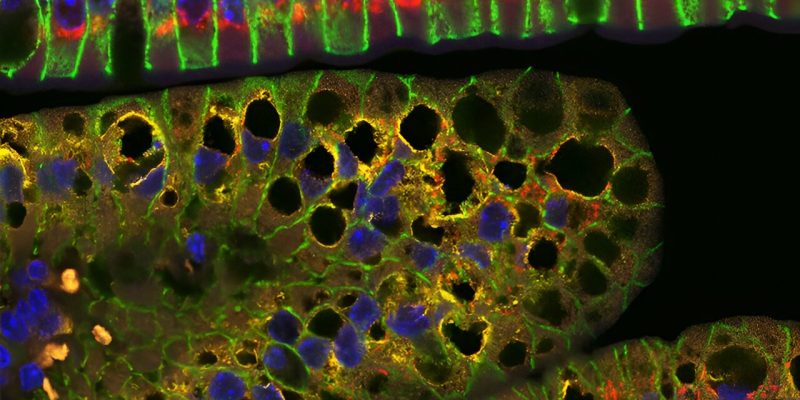 Studie enthüllt Rolle von Mitochondrien bei der Verarbeitung von Nahrungsfetten