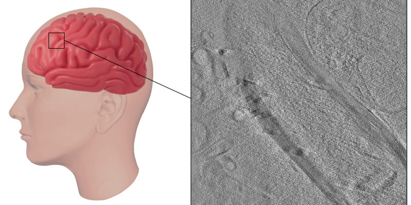 Verwendung von Ionenstrahlen zur Verbesserung der Gehirnmikroskopie