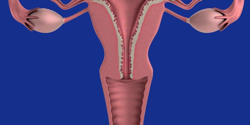 Studie zeigt, dass die Überprüfung des Zustands der Gebärmutter das Krebsrisiko senken könnte